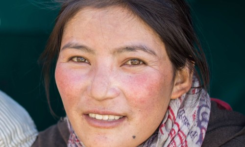 女人肺火旺脸上长疙瘩图片-肺火旺盛脸上长痘痘-专业女人肺火旺脸上长疙瘩图片平台-肺热导致脸上长痘怎么治
